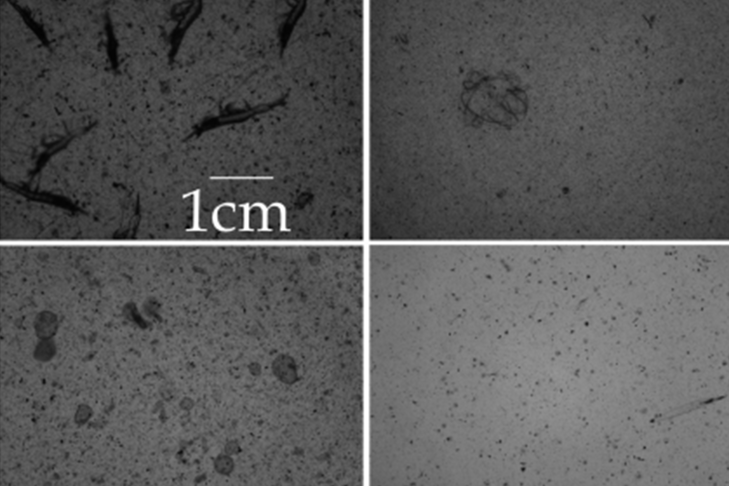 守在海里的&ldquo;眼睛&rdquo;：一年130万张照片，看清浮游生物的秘密